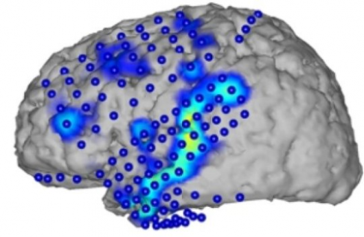 Распознавание речи по деятельности мозга