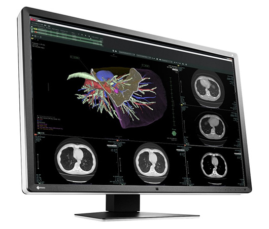 30-дюймовый профессиональный монитор EIZO RadiForce RX660 имеет разрешение 3280×2048 30-дюймовый профессиональный монитор EIZO RadiForce RX660 имеет разрешение 3280×2048