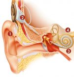 Кохлеарные импланты – процессоры возвращают слух